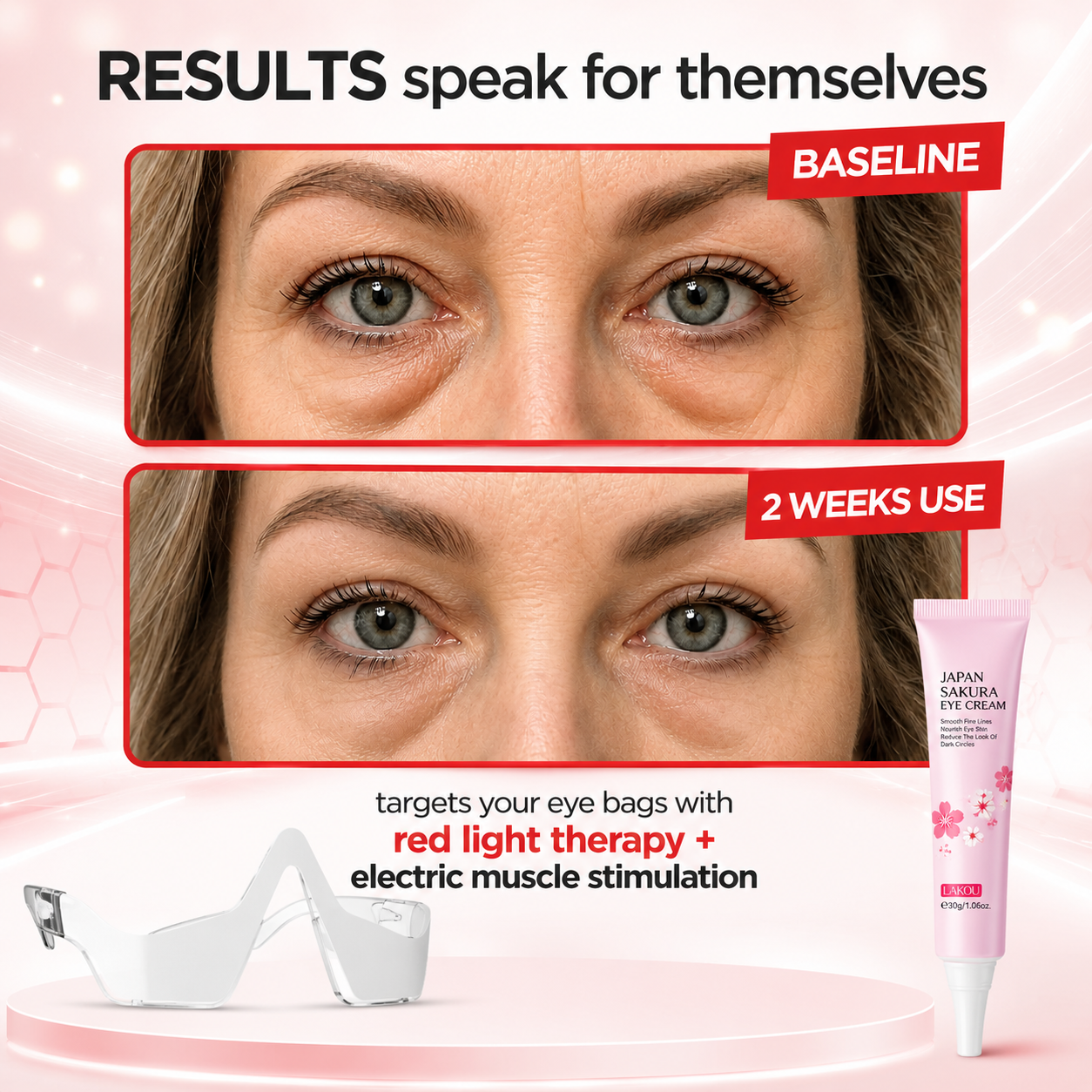 Ominix RevitalEyes 2-in-1 Red Light Therapy + EMS To Erase Eye Bags