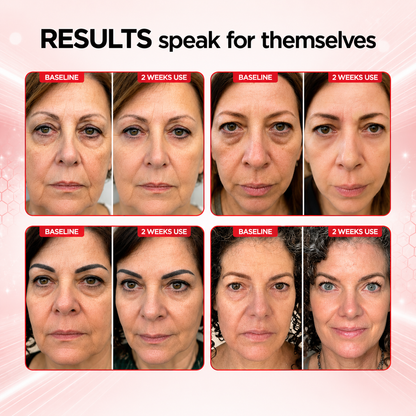 Ominix RevitalEyes 2-in-1 Red Light Therapy + EMS To Erase Eye Bags